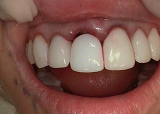 r13